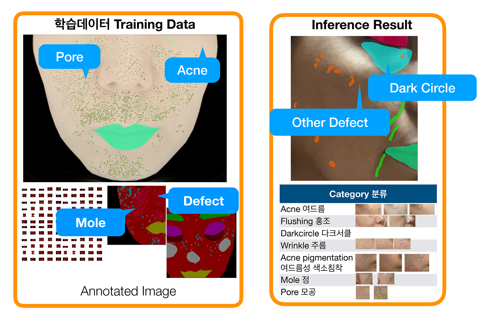 얼굴 피부 분석 Face Skin Analytics